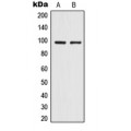 LifeSab™ TRPV4 Rabbit pAb (50 µl)