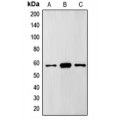 LifeSab™ FTO Rabbit pAb (50 µl)