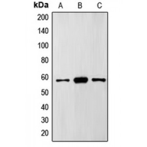 LifeSab™ FTO Rabbit pAb (50 µl)