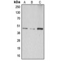 LifeSab™ ABHD8 Rabbit pAb (50 µl)