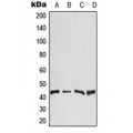 LifeSab™ DGAT2 Rabbit pAb (50 µl)