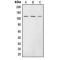 LifeSab™ EPHA3 (pY602) Rabbit pAb (50 µl)