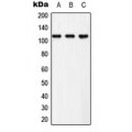 LifeSab™ EPHB3 (pY608) Rabbit pAb (50 µl)