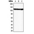 LifeSab™ EPHB3 Rabbit pAb (50 µl)