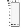 LifeSab™ HMGA1 Rabbit pAb (50 µl)