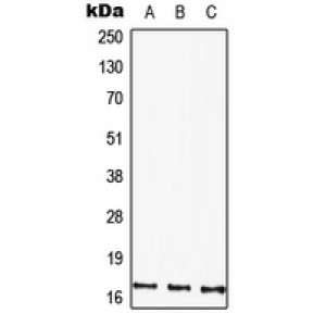 LifeSab™ HMGA1 Rabbit pAb (50 µl)