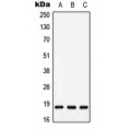 LifeSab™ MAX (pS11) Rabbit pAb (50 µl)
