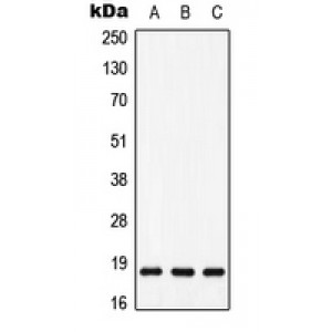 LifeSab™ MAX (pS11) Rabbit pAb (50 µl)