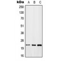 LifeSab™ GADD45 beta Rabbit pAb (50 µl)