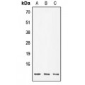 LifeSab™ POLR2K Rabbit pAb (50 µl)