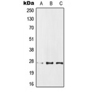 LifeSab™ IPP1 Rabbit pAb (50 µl)