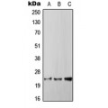 LifeSab™ RGS4 Rabbit pAb (50 µl)