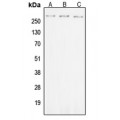 LifeSab™ ROS (pY2114) Rabbit pAb (50 µl)