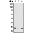 LifeSab™ RPS27 Rabbit pAb (50 µl)