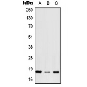 LifeSab™ RPS27 Rabbit pAb (50 µl)