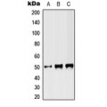 LifeSab™ ST3N Rabbit pAb (50 µl)