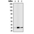 LifeSab™ SLUG Rabbit pAb (50 µl)