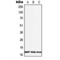 LifeSab™ TGF alpha Rabbit pAb (50 µl)