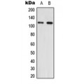 LifeSab™ NNT Rabbit pAb (50 µl)