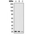LifeSab™ NIP7 Rabbit pAb (50 µl)