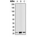 LifeSab™ RAB14 Rabbit pAb (50 µl)