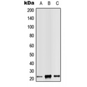 LifeSab™ RAB14 Rabbit pAb (50 µl)