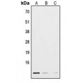 LifeSab™ POLR3K Rabbit pAb (50 µl)