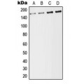 LifeSab™ CD246 Rabbit pAb (50 µl)