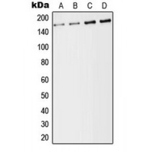 LifeSab™ CD246 Rabbit pAb (50 µl)