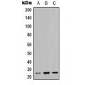 LifeSab™ MASH1 Rabbit pAb (50 µl)