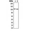 LifeSab™ CNGB1 Rabbit pAb (50 µl)