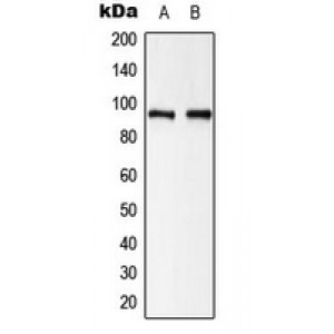 LifeSab™ Beta-catenin Rabbit pAb (50 µl)