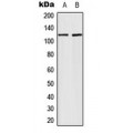 LifeSab™ FGFR1 Rabbit pAb (50 µl)