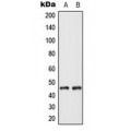 LifeSab™ Cytokeratin 18 Rabbit pAb (50 µl)