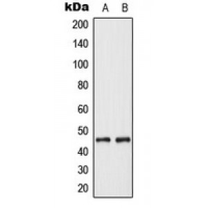 LifeSab™ Cytokeratin 18 Rabbit pAb (50 µl)
