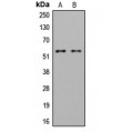 LifeSab™ LYN (pY508) Rabbit pAb (50 µl)