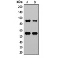LifeSab™ MDM2 (pS166) Rabbit pAb (50 µl)