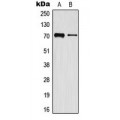 LifeSab™ MMP16 Rabbit pAb (50 µl)