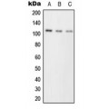 LifeSab™ PKC mu Rabbit pAb (50 µl)