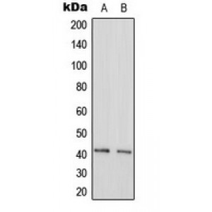 LifeSab™ GAS41 Rabbit pAb (50 µl)