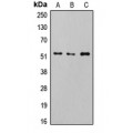LifeSab™ SMAD2/3 (pT8) Rabbit pAb (50 µl)