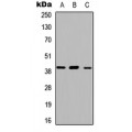 LifeSab™ ABHD13 Rabbit pAb (50 µl)
