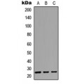 LifeSab™ CABP2 Rabbit pAb (50 µl)