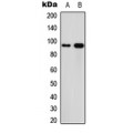 LifeSab™ Calpain 3 Rabbit pAb (50 µl)