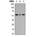 LifeSab™ Cathepsin C HC Rabbit pAb (50 µl)