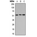 LifeSab™ Cathepsin C LC Rabbit pAb (50 µl)