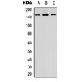 LifeSab™ CYFIP1 Rabbit pAb (50 µl)