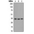 LifeSab™ EB2 Rabbit pAb (50 µl)
