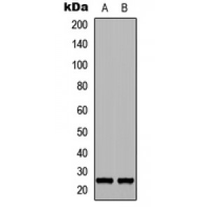LifeSab™ FGF17 Rabbit pAb (50 µl)