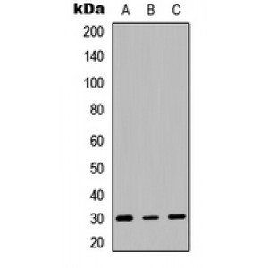LifeSab™ HLA-DQB1 Rabbit pAb (50 µl)